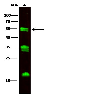 Recombinant Carboxypeptidase M Monoclonal Antibody-searchlist-1