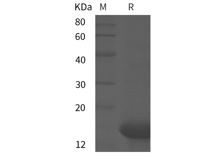 Recombinant Mouse GM-CSF Protein(His Tag)-产品推荐-1