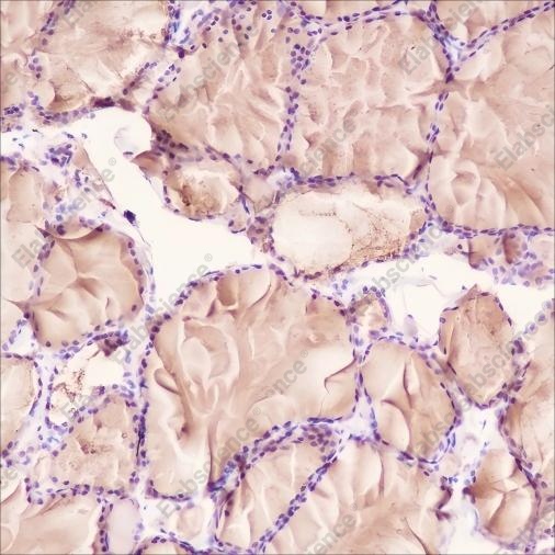 Recombinant Thyroglobulin Monoclonal Antibody - 2