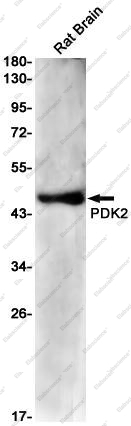 Recombinant PDK2 Monoclonal Antibody - 1