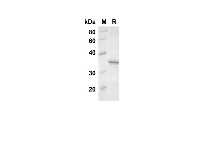 Recombinant Human CXCL1 Protein(GST Tag)-产品推荐-1