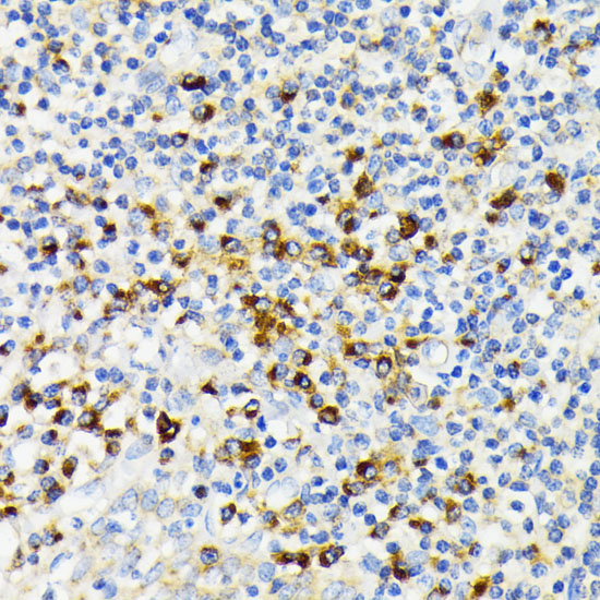 Immunohistochemistry of paraffin-embedded Human tonsil using USO1 Polyclonal Antibody at dilution of 1:100 (40x lens).