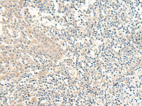 Immunohistochemistry of paraffin-embedded Human tonsil tissue  using GPR161 Polyclonal Antibody at dilution of 1:40(?200)