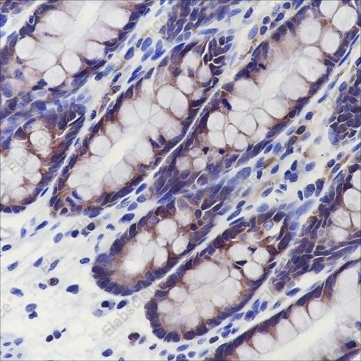Recombinant eIF3B Monoclonal Antibody - 2