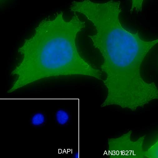 Recombinant PHB2 Monoclonal Antibody - small - 2