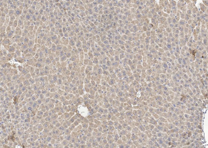 Recombinant Erythropoietin Monoclonal Antibody - small - 2
