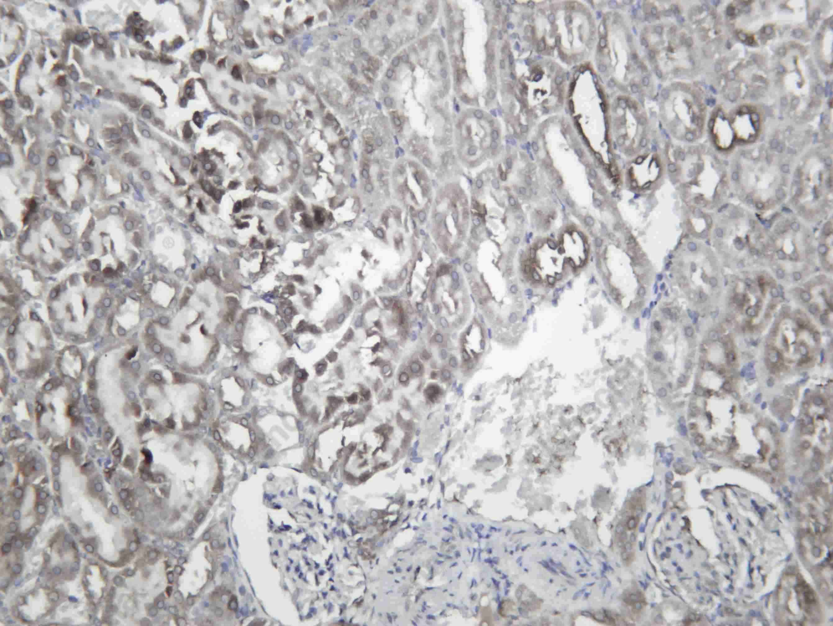 Recombinant FDFT Monoclonal Antibody - 2