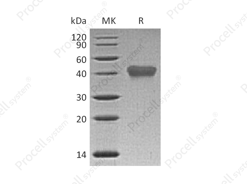 TNFR2/TNFRSF1B/CD120b (C-6His), Human, Recombinant