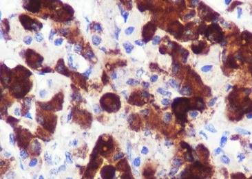 Recombinant ACTH Monoclonal Antibody-searchlist-1