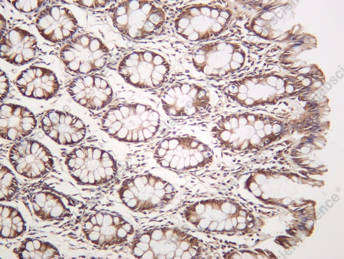 Recombinant FOSL2 Monoclonal Antibody - 1