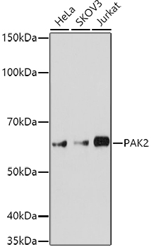 Western blot analysis of extracts of various cell lines using PAK2 Polyclonal Antibody at 1:1000 dilution.