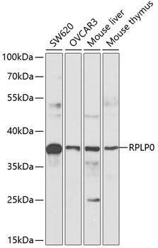Western blot analysis of extracts of various cell lines using RPLP0 Polyclonal Antibody at 1:1000 dilution.