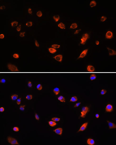 Immunofluorescence analysis of L929 cells using ARL13B Polyclonal Antibody at dilution of  1:100. Blue: DAPI for nuclear staining.