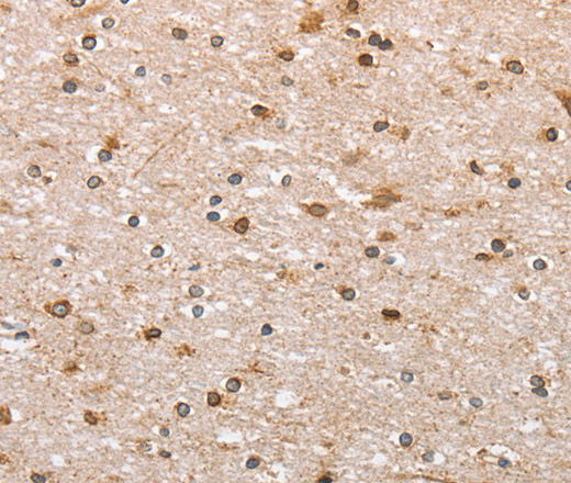 Immunohistochemistry of paraffin-embedded Human brain  using CANX Polyclonal Antibody at dilution of 1:50