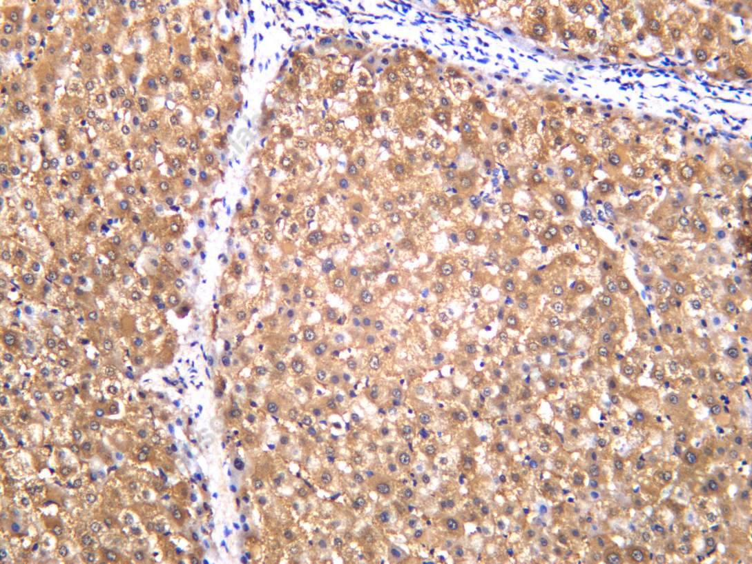 Recombinant L-Lactyl Lysine Monoclonal Antibody - 1