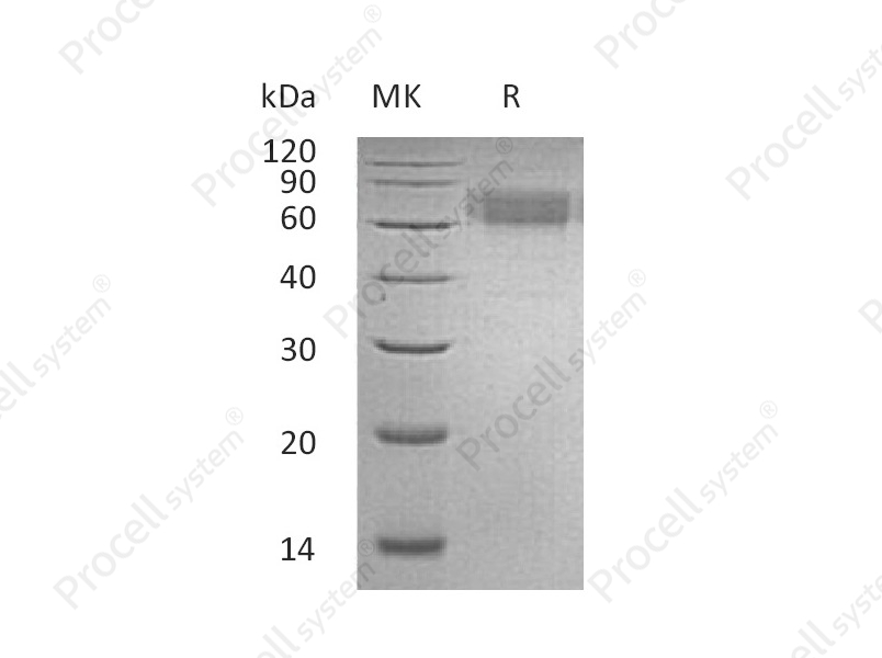 IL-6R&alpha;/CD126, Human, Recombinant