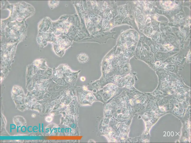 MDA-MB-175VII (DMEM) Cell Complete Medium - 4