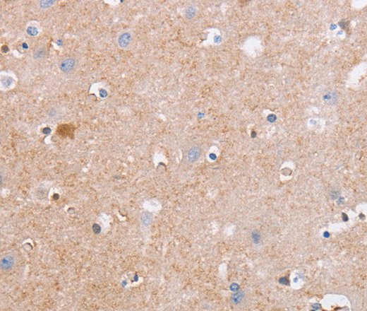 Immunohistochemistry of paraffin-embedded Human brain tissue using CDC7 Polyclonal Antibody at dilution 1:50