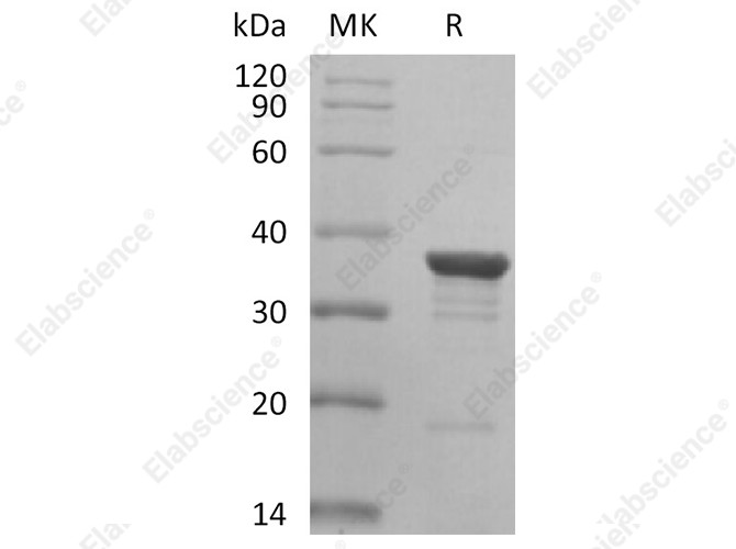 Recombinant Human AKR1C2 Protein - 1