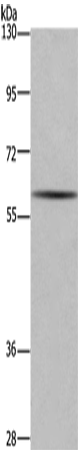 Western Blot analysis of Human fetal brain tissue using GAD1 Polyclonal Antibody at dilution of 1:571