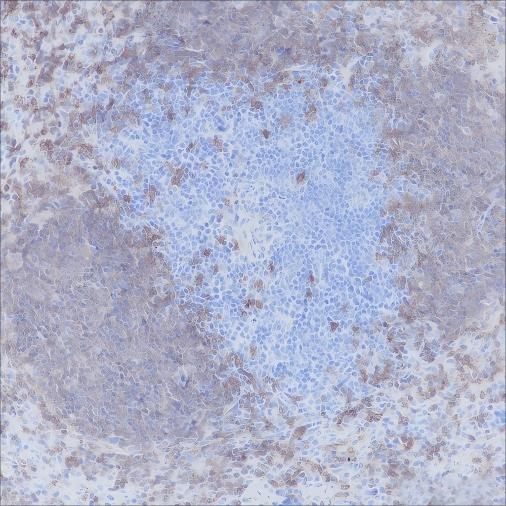 Recombinant CD20 Monoclonal Antibody - small - 3