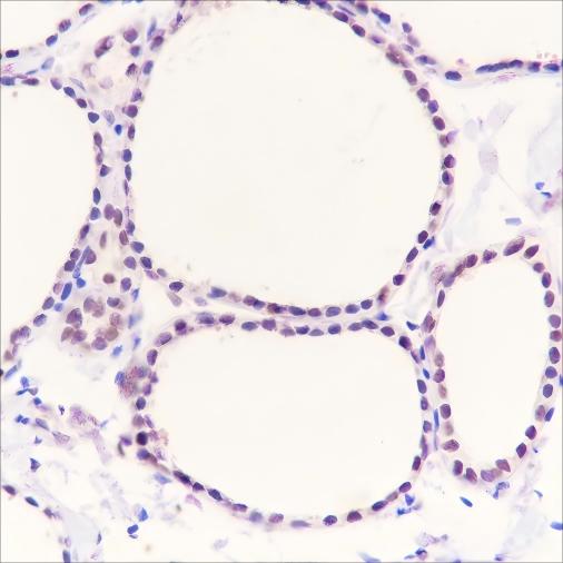 Recombinant PAX8 Monoclonal Antibody-searchlist-1