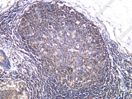 Recombinant IKKε Monoclonal Antibody - 1