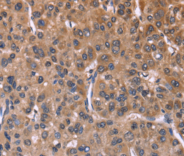 SEPT7 Polyclonal Antibody - 3