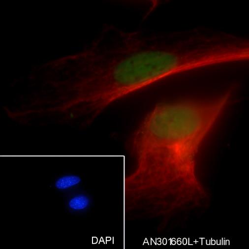 Recombinant SOX1 Monoclonal Antibody - 3