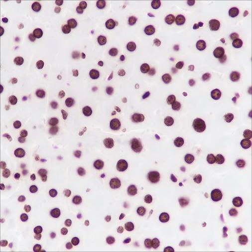 Recombinant Histone H3 (Mono Methyl Lys36) Monoclonal Antibody - small - 5