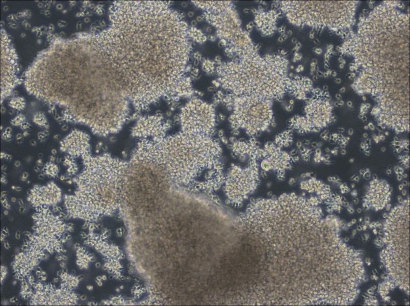 NCI-BL2009 Cell Complete Medium - 3