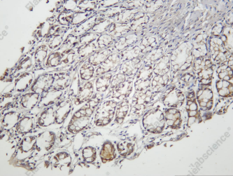 Recombinant Claudin 4 Monoclonal Antibody - 2