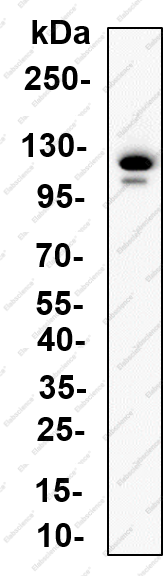 Recombinant Smoothelin Monoclonal Antibody - 4