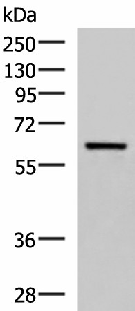 Western blot analysis of Human fetal brain tissue lysate  using SARS Polyclonal Antibody at dilution of 1:850