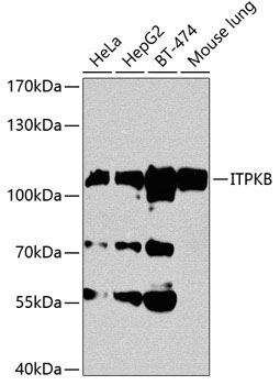 Western blot analysis of extracts of various cell lines using ITPKB Polyclonal Antibody at 1:1000 dilution.