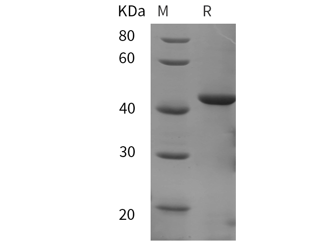 Recombinant Mouse Fas/TNFRSF6/CD95 Protein(Fc Tag)-产品推荐-1