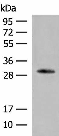 Western blot analysis of Human left thymus tissue lysate  using VDAC3 Polyclonal Antibody at dilution of 1:200