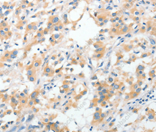 RPN1 Polyclonal Antibody - 3