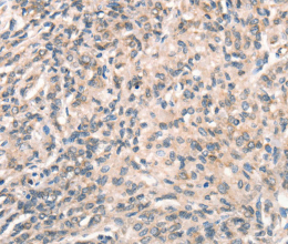 DECR1 Polyclonal Antibody - 3