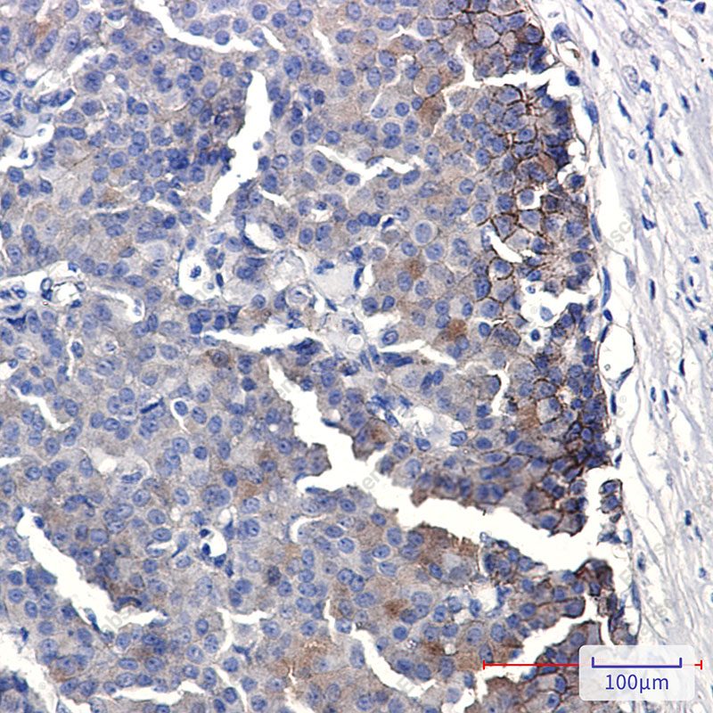 Recombinant EPHB4 Monoclonal Antibody - 2