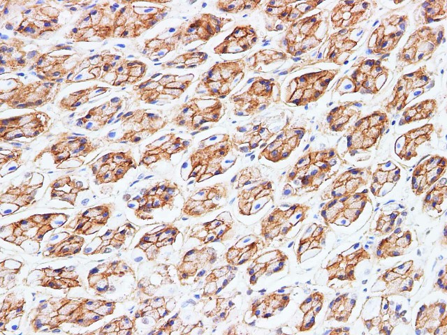 Purified Anti-Human CD33 Antibody[6C5]-产品推荐-1
