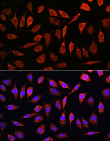 Immunofluorescence analysis of L929 cells using ZIP8 Polyclonal Antibody at dilution of 1:100. Blue: DAPI for nuclear staining.