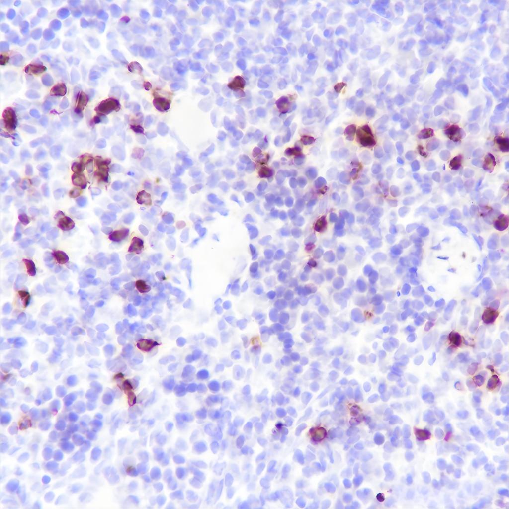 Recombinant S100A8 Monoclonal Antibody - small - 4