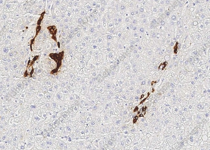 KRT19 Monoclonal Antibody - 2