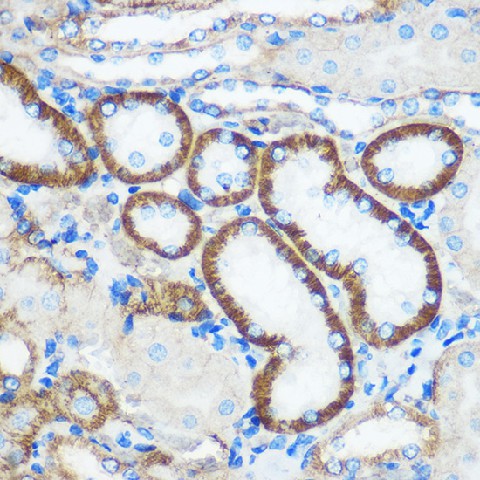 Immunohistochemistry of paraffin-embedded Mouse kidney using PEBP4 Polyclonal Antibody at dilution of 1:100 (40x lens).Perform microwave antigen retrieval with 10 mM PBS buffer pH 7.2 before commencing with IHC staining protocol.