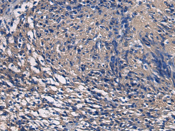 Immunohistochemistry of paraffin-embedded Human brain tissue  using SSH3 Polyclonal Antibody at dilution of 1:55(?200)