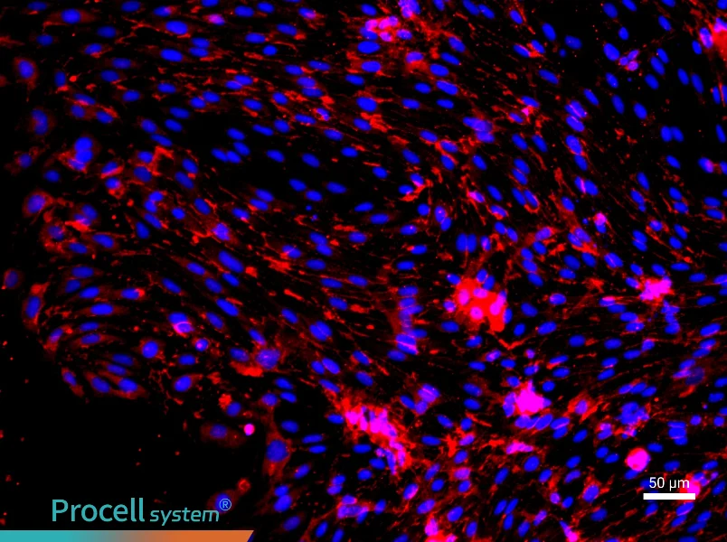 Rat Cardiac Microvascular Endothelial Cell Complete Medium - 1