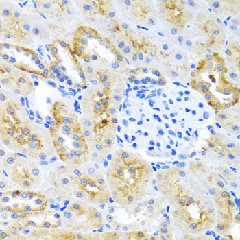 Immunohistochemistry of paraffin-embedded Mouse kidney using MOK Polyclonal Antibody at dilution of  1:100 (40x lens).