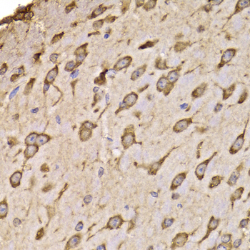 Immunohistochemistry of paraffin-embedded Mouse brain using RPS14 Polyclonal Antibody at dilution of  1:100 (40x lens).