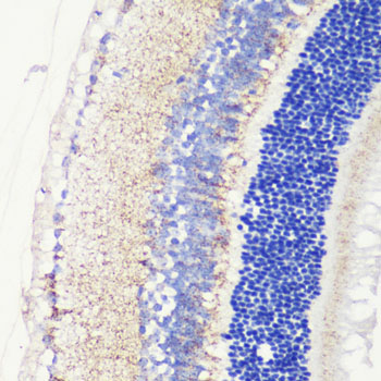 Immunohistochemistry of paraffin-embedded mouse retina using CRB1 Polyclonal Antibody at dilution of 1:200 (40x lens).Perform microwave antigen retrieval with 10 mM PBS buffer pH 7.2 before commencing with IHC staining protocol.